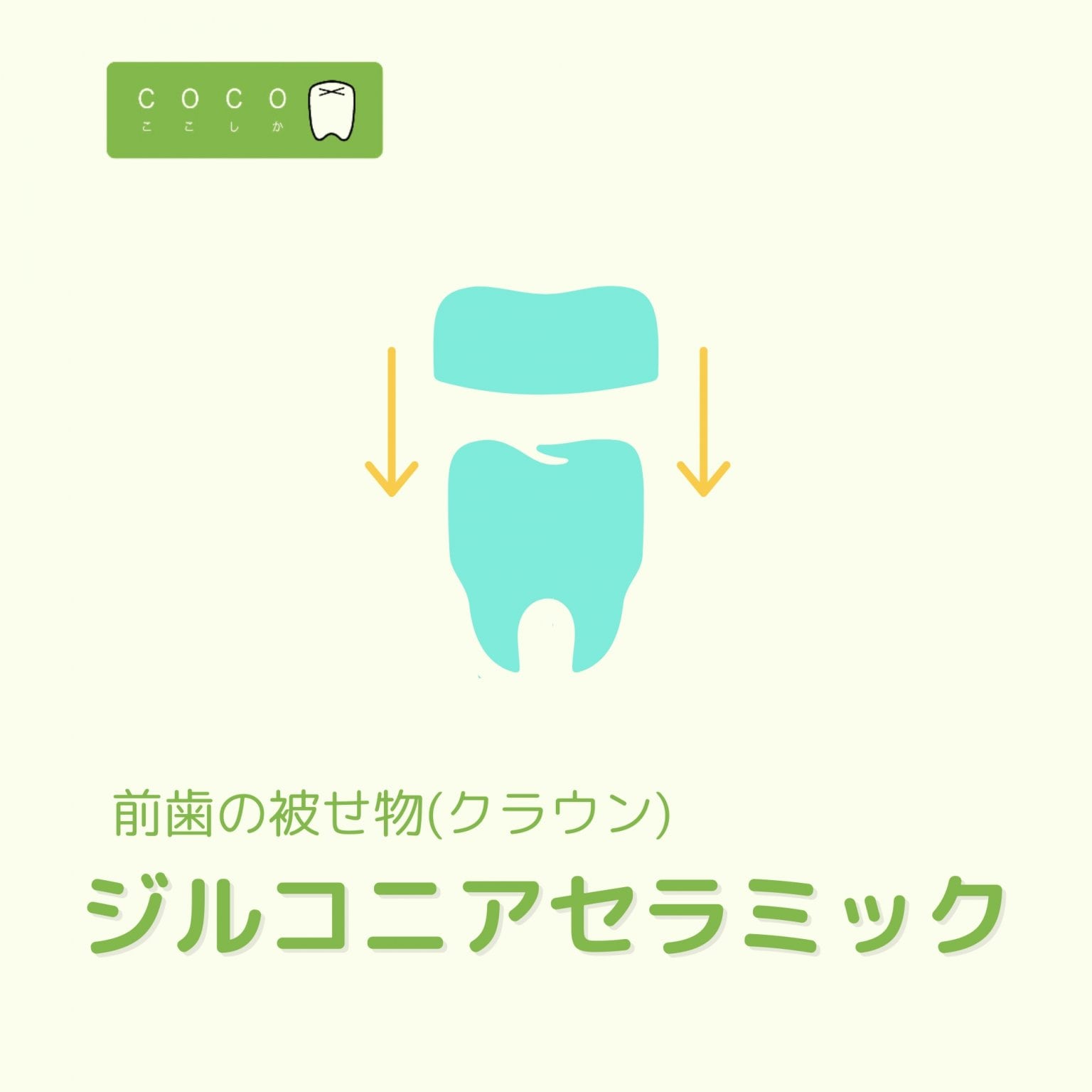 [AKさま]ジルコニアセラミック冠