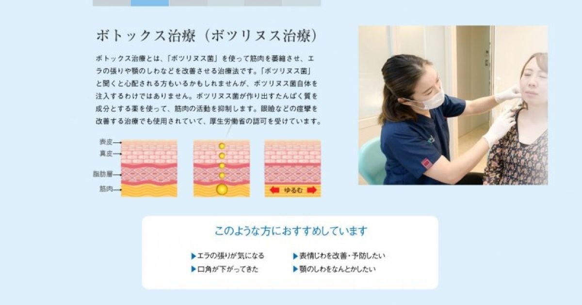 ボトックス/１か所