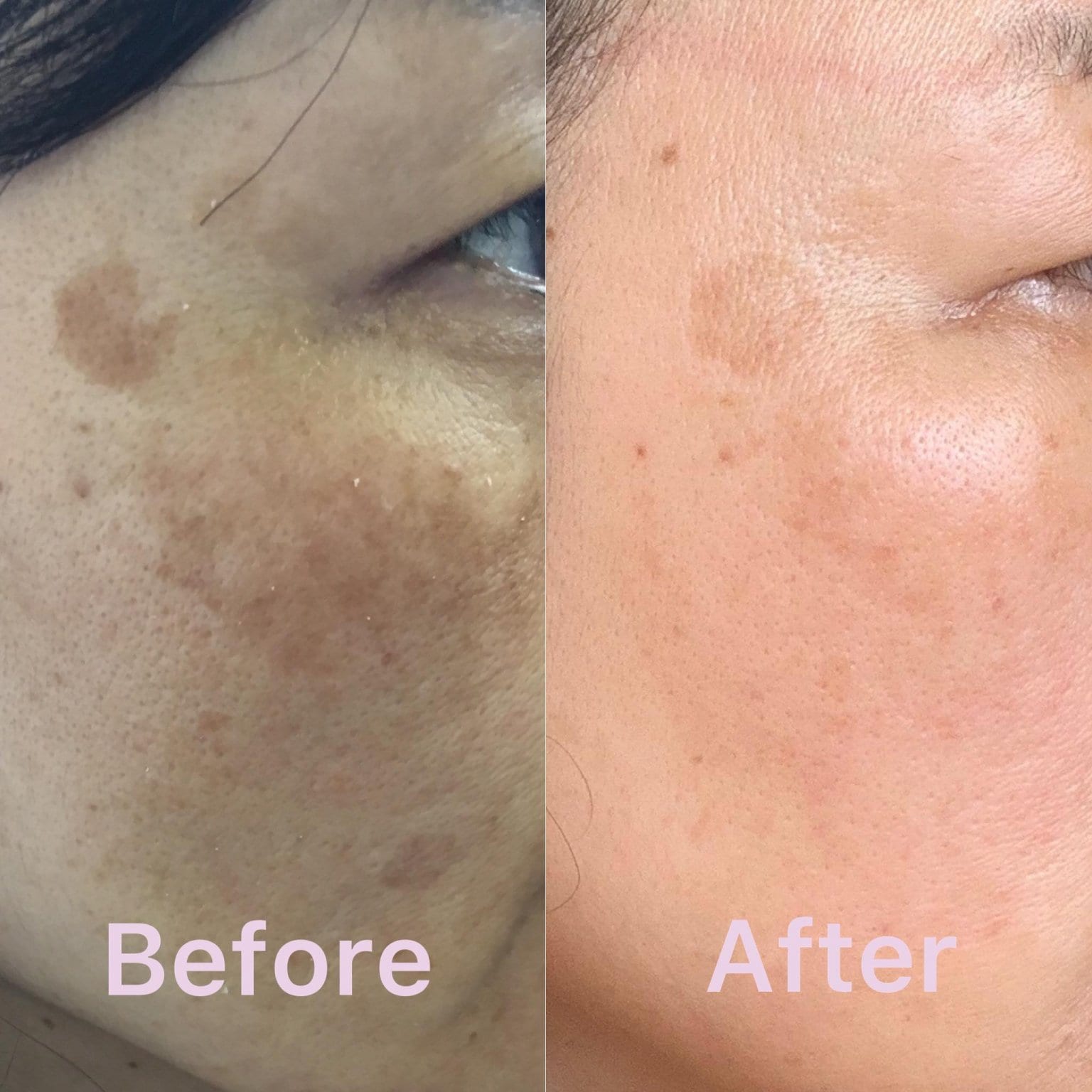 3月26日『ロンドンセレブ御用達〜毎日5分でグングン若返るV字型セルフフェイスケア』【Zoomワークショップ／録画配信あり】Aromatherii