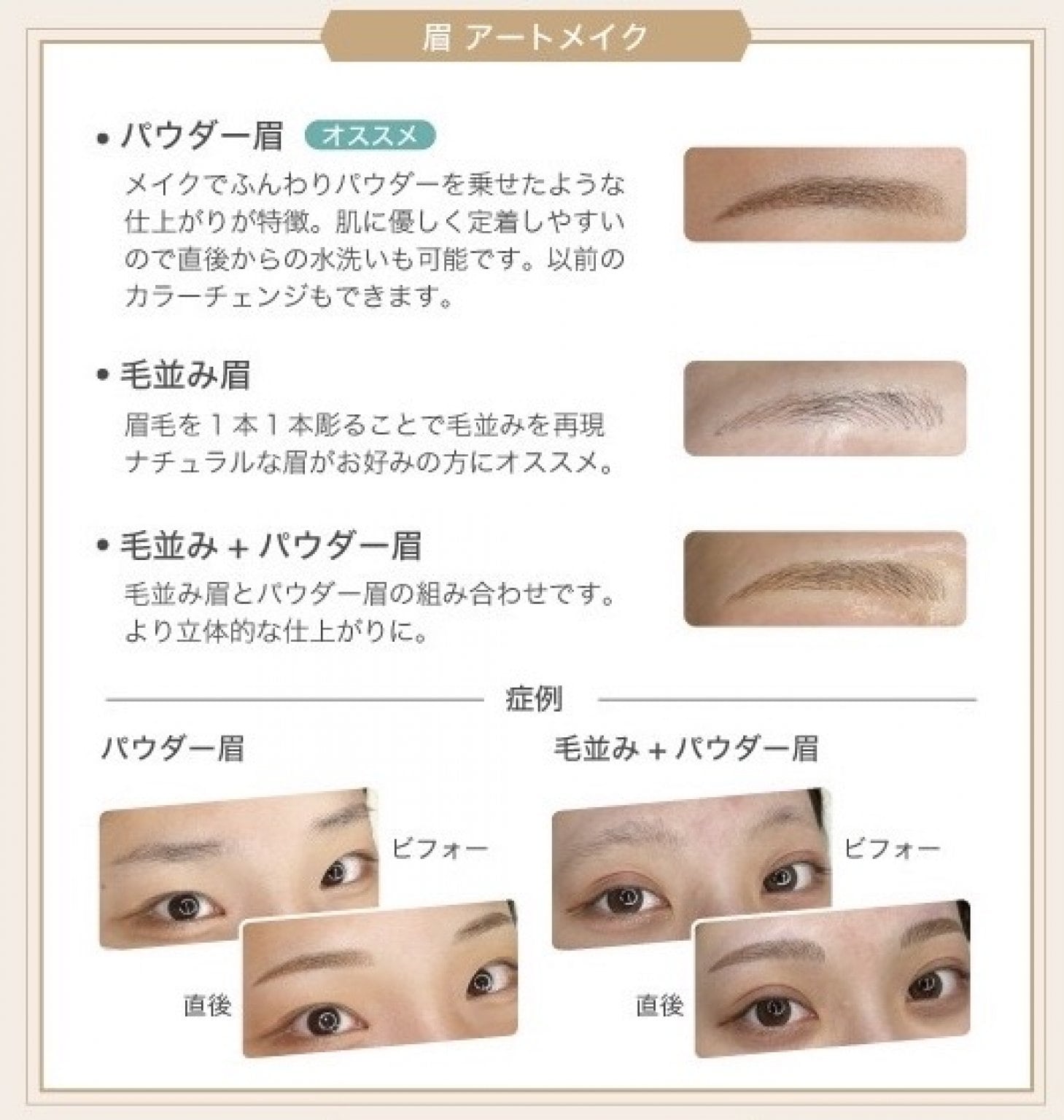 アートメイク 眉orリップ 1回目 モニター価格 - アロリエクリニック