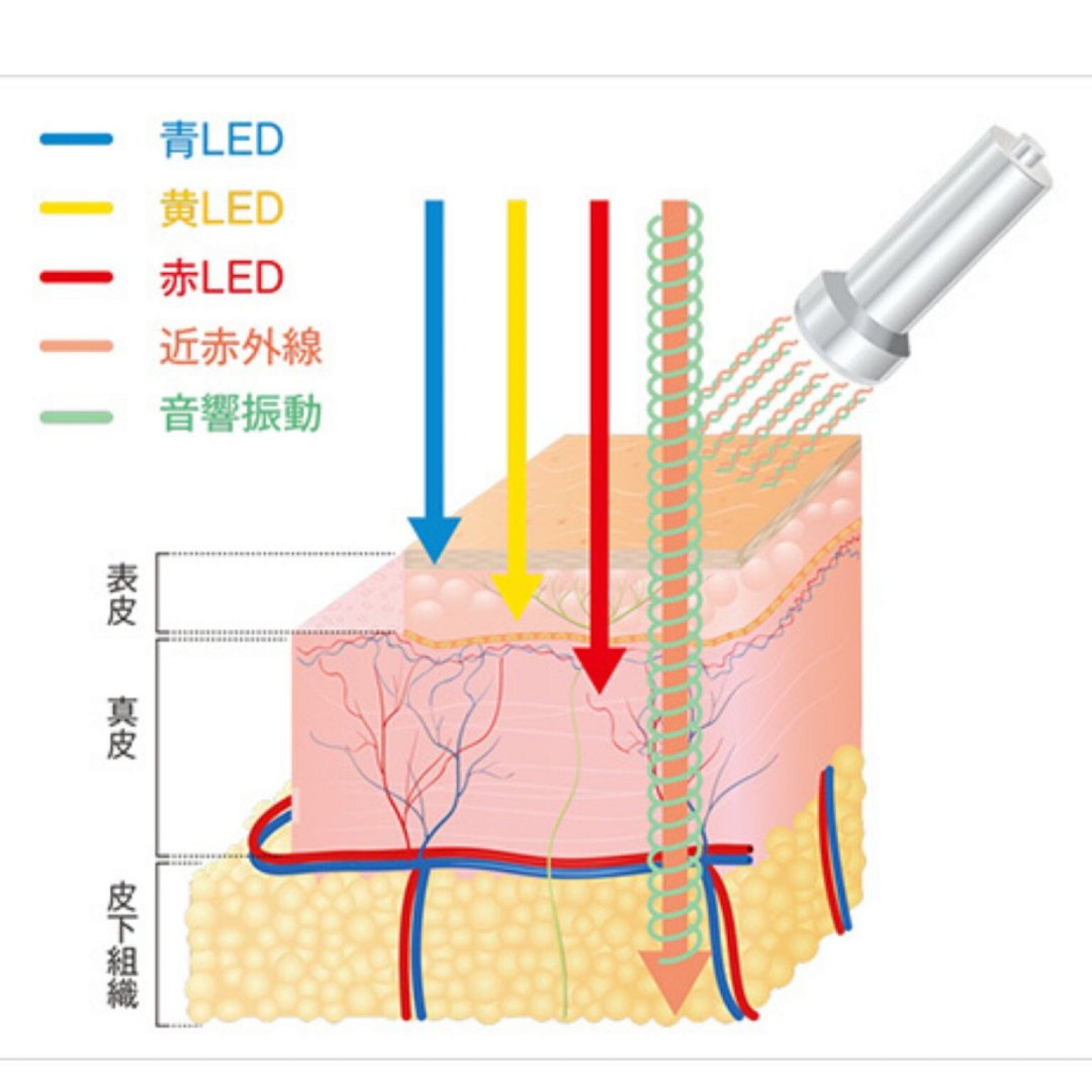 【薄毛のお悩みに】針不使用の育毛剤導入