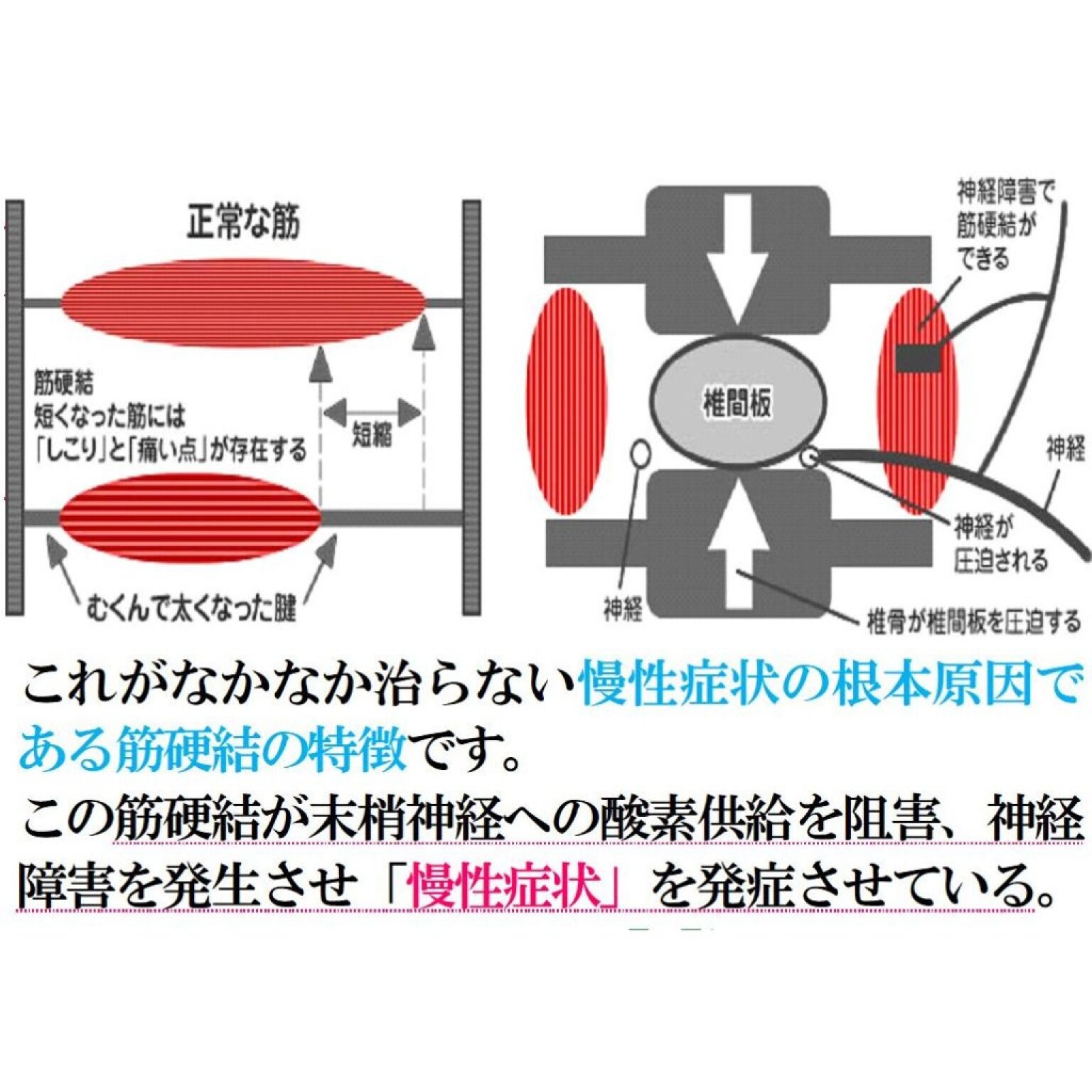 VIP　マイオセラピーコース　120分