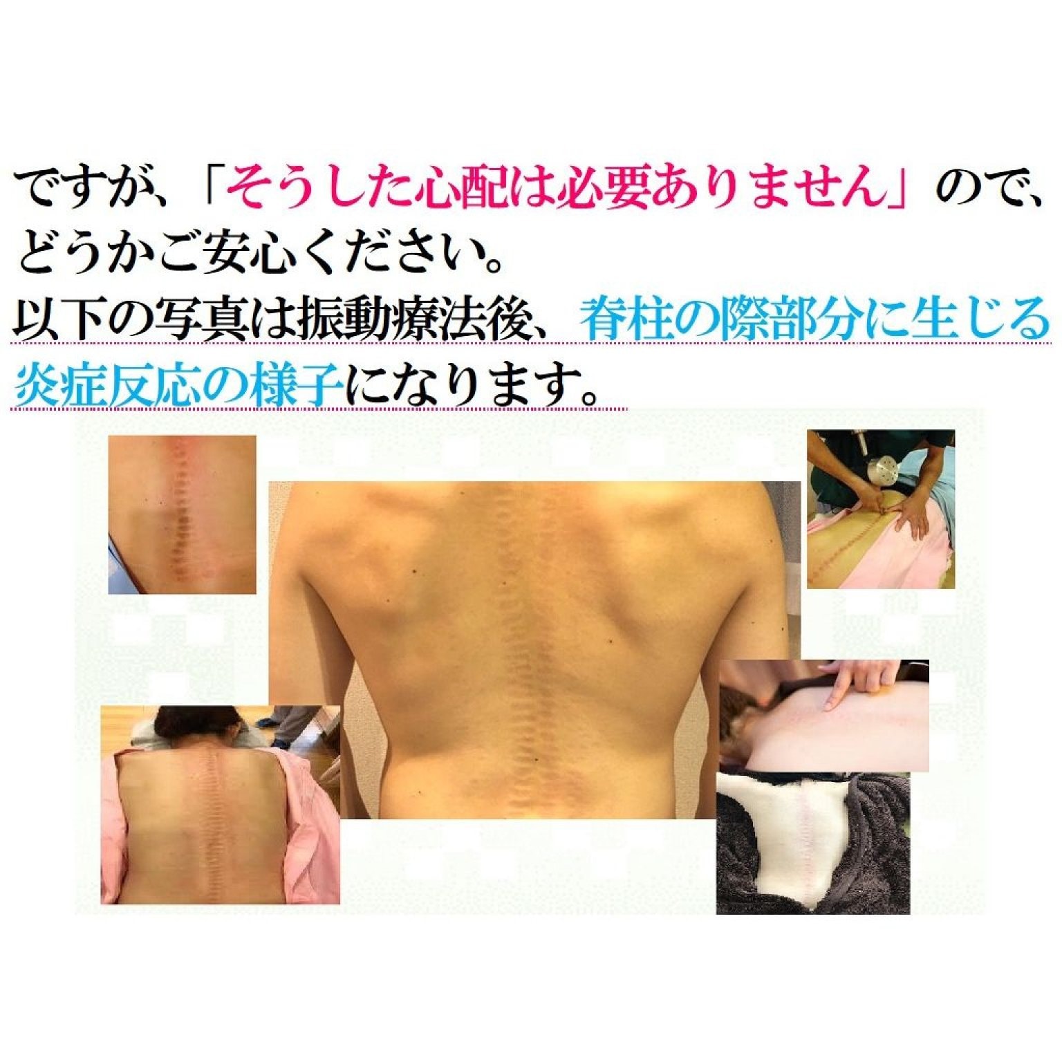 VIP　マイオセラピーコース　120分