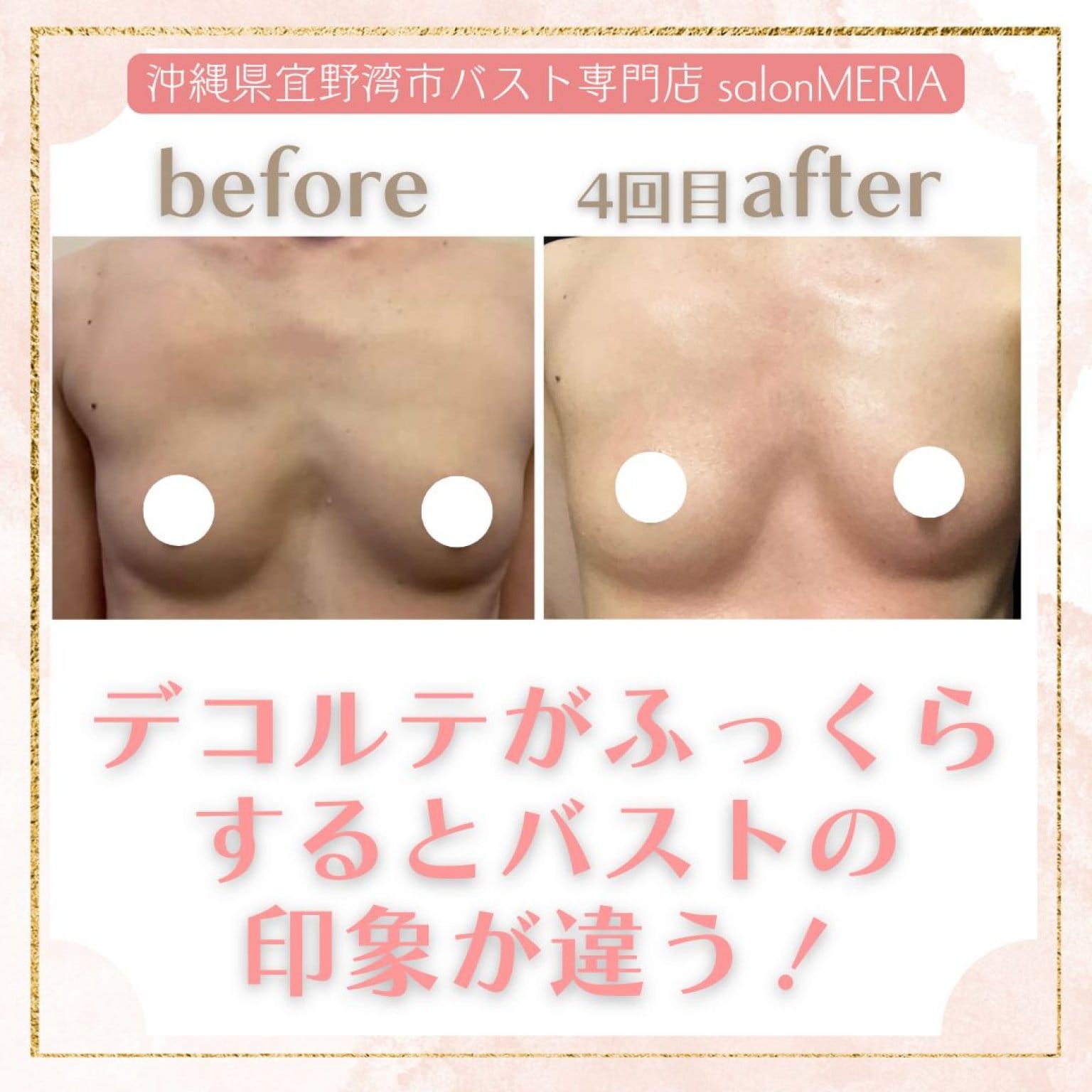 【初回モニター価格】全身オールハンドやわハリ美バストコース(120〜150分)「カウンセリング×乳腺を育てるマッサージ×背中・筋膜リリース×下着フィッティング×セルフケア」沖縄県宜野湾市バストケア専門SalonMERIA(サロンメリア)