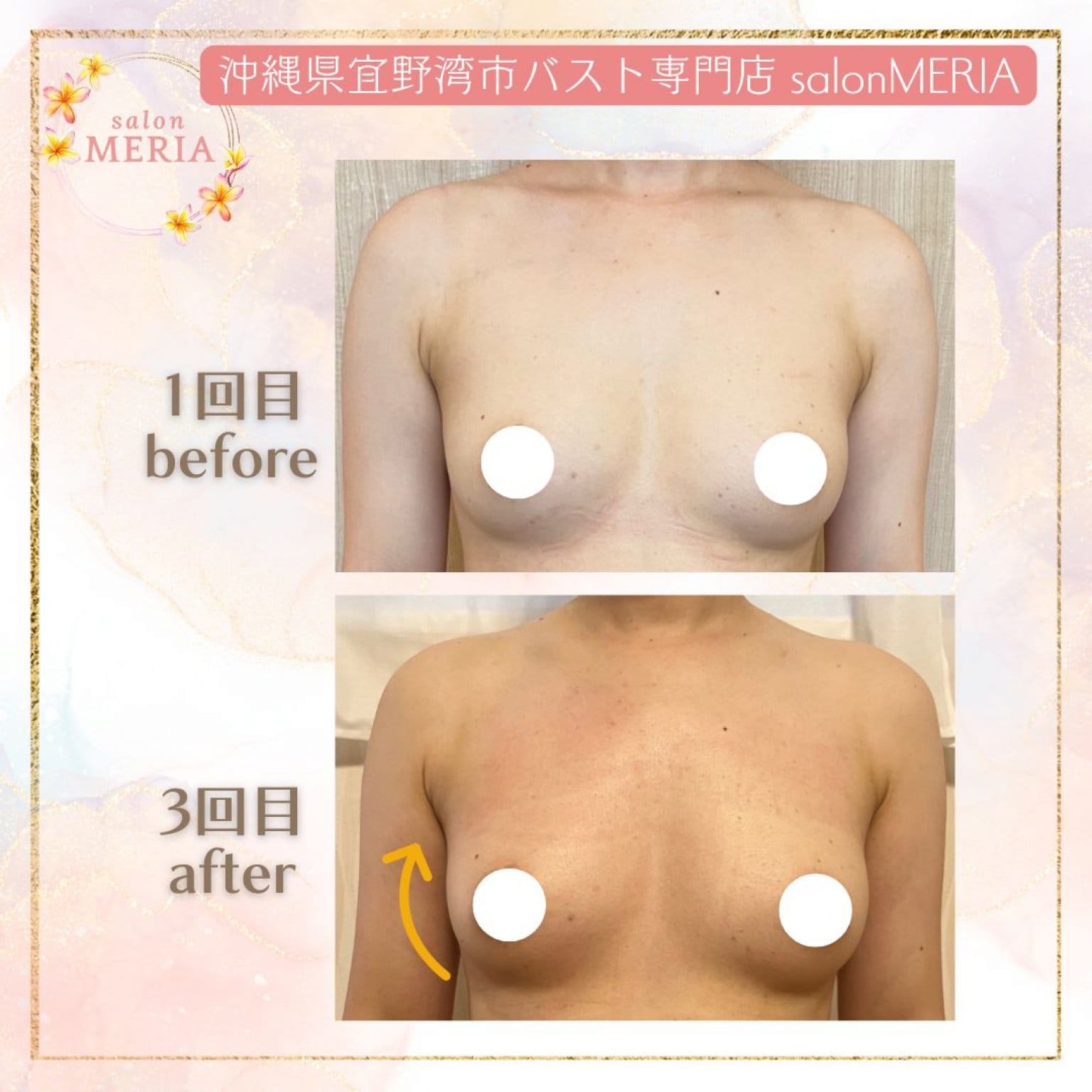 【初回モニター価格】全身オールハンドやわハリ美バストコース(120〜150分)「カウンセリング×乳腺を育てるマッサージ×背中・筋膜リリース×下着フィッティング×セルフケア」沖縄県宜野湾市バストケア専門SalonMERIA(サロンメリア)