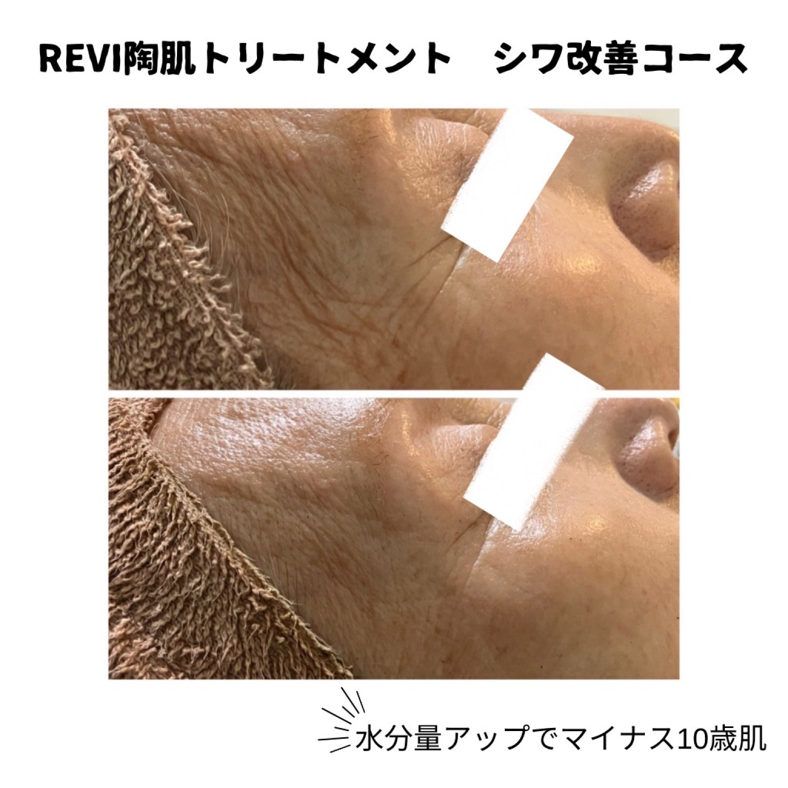 ラグジュアリーコース REVI陶肌トリートメント ￥36,650→￥32,450