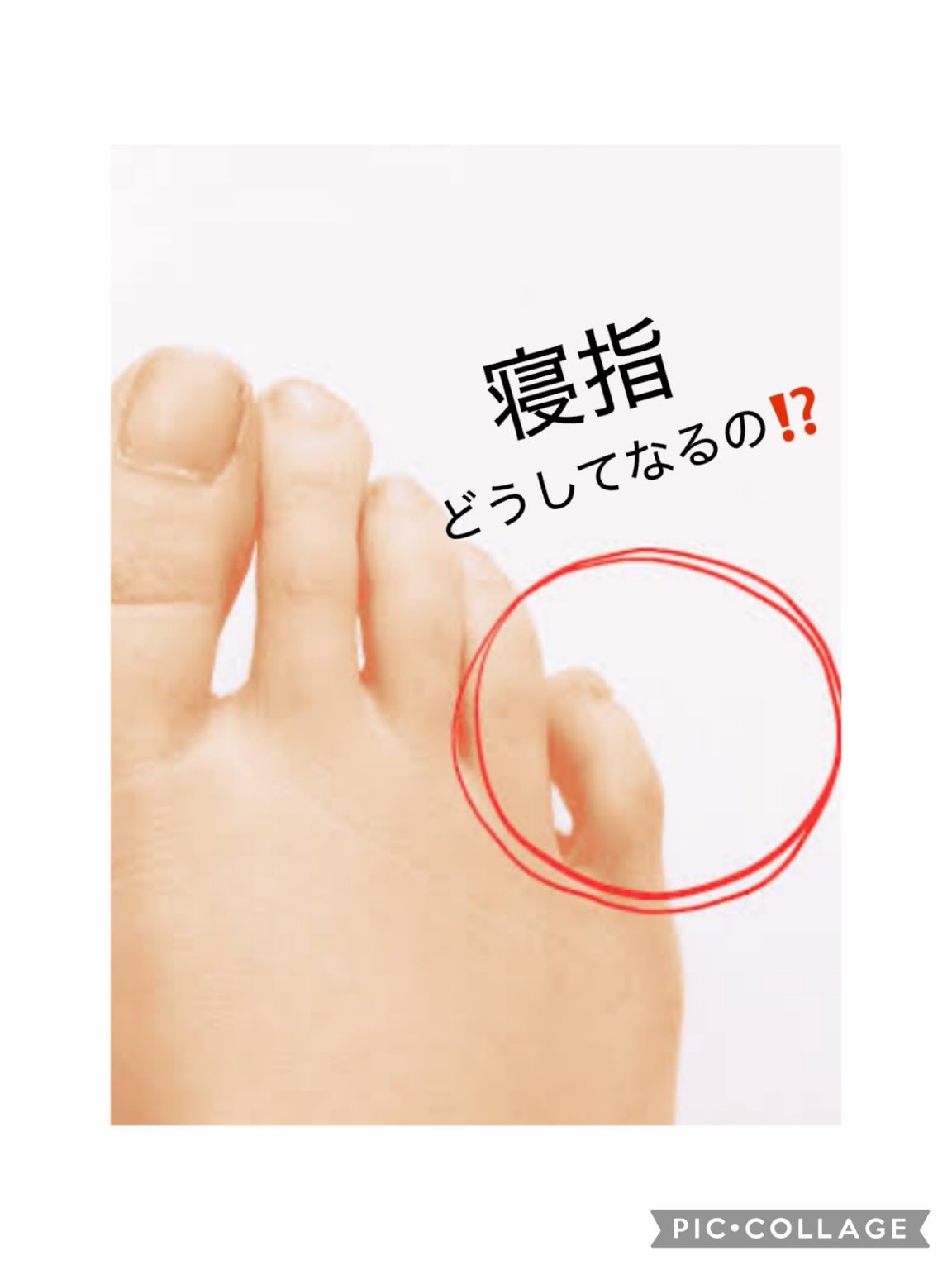 ★人気No1★ 外反母趾・寝指・扁平足・巻き爪・足のトラブル改善フットケア　45分 通常9900円 → 6600円