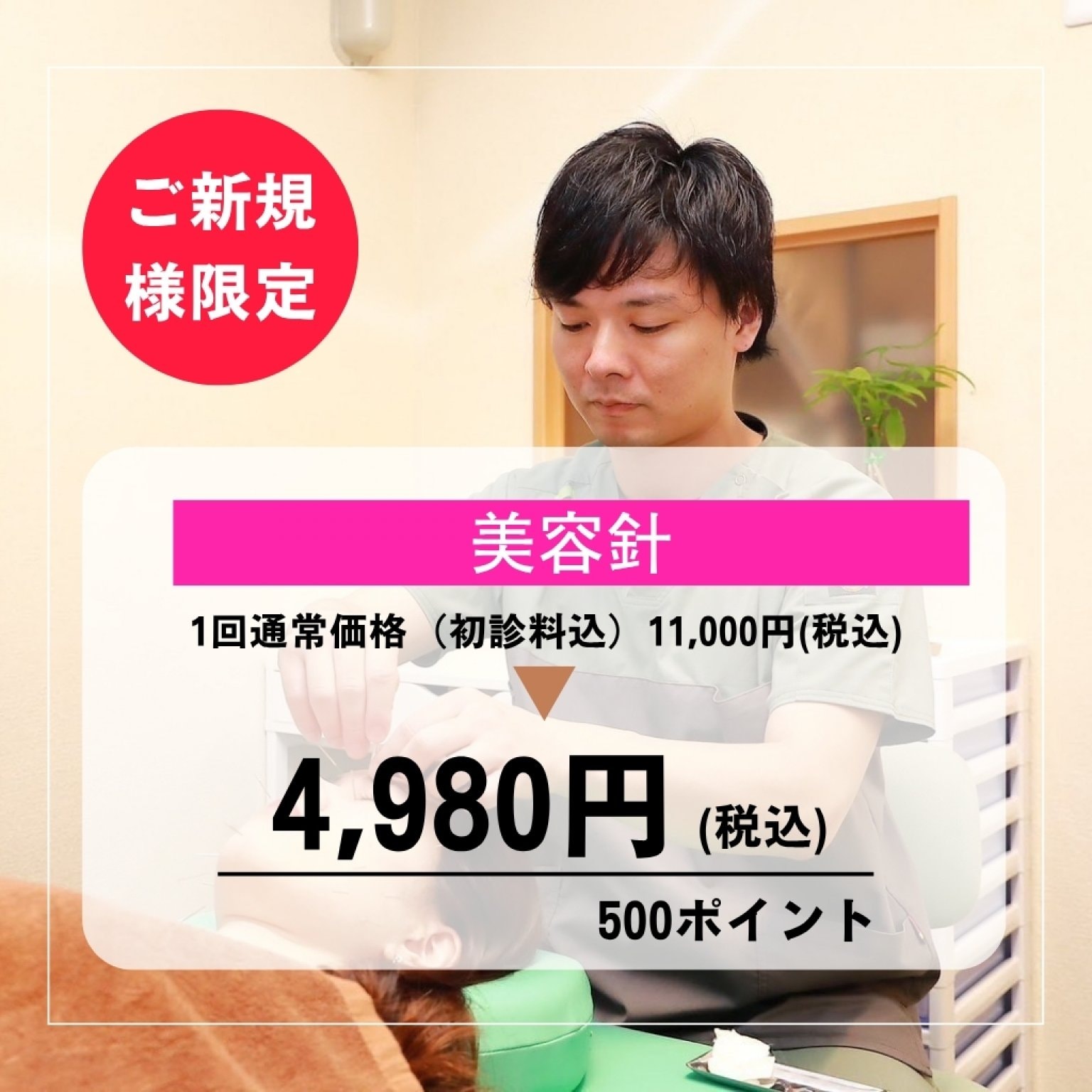 ★初回限定★美容鍼（60～70本）〈たるみ・肌質改善・背中ニキビ・首のしわ・ほうれい線など〉