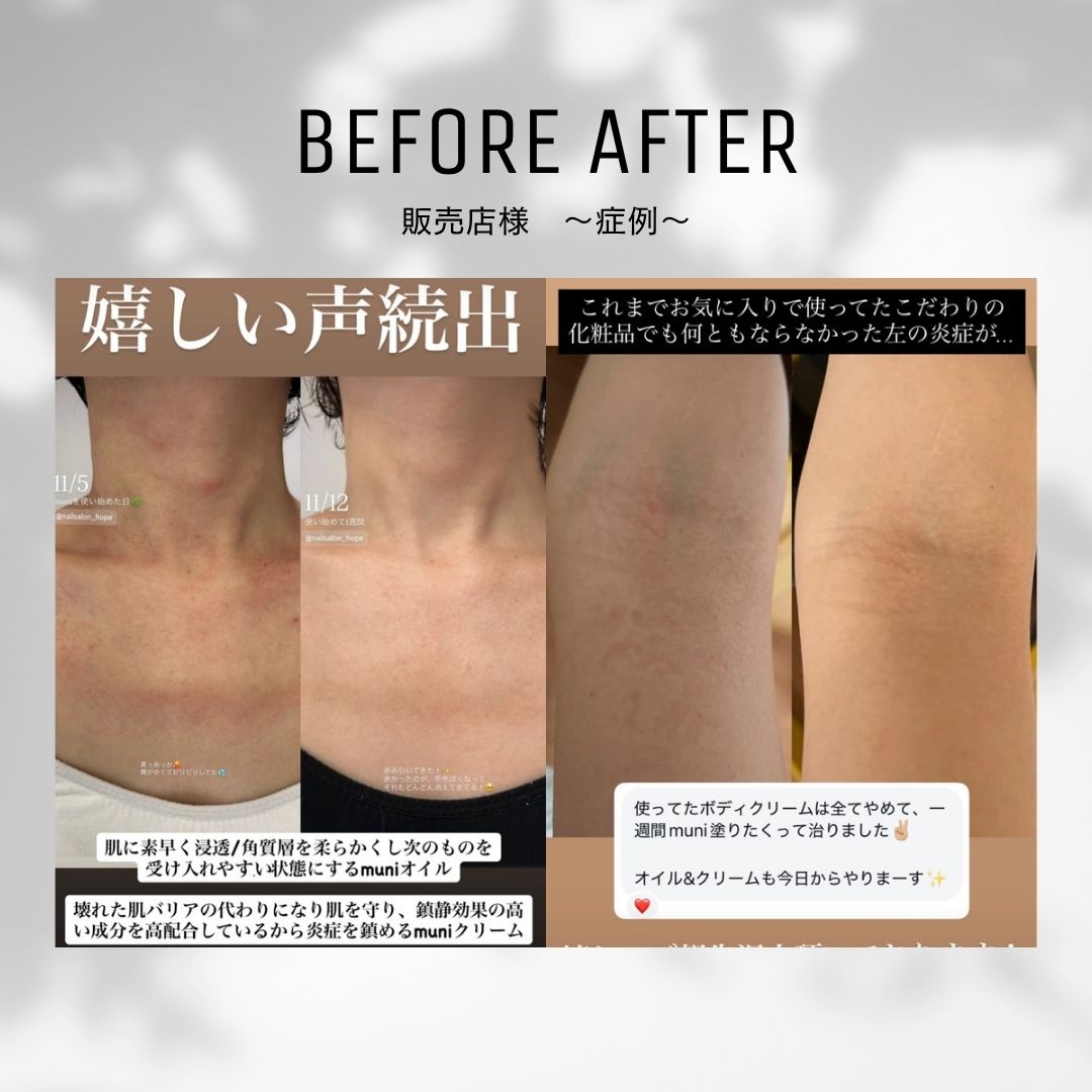 muni美容クリーム】|乾燥肌|敏感肌|アトピー|主婦湿疹|55g|鎮静化の