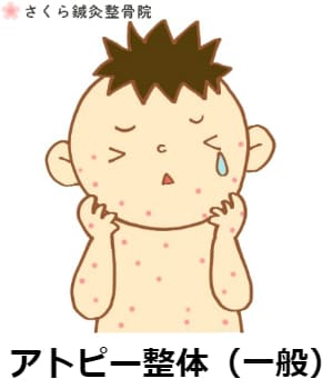 京都市伏見区、さくら鍼灸整骨院、シータヒーリング®、産前産後ケア、産後の骨盤矯正、骨盤矯正、マタニティ整体、アクシスメソッド、アトピー、セルフホワイトニング【併設：さくら整体院、心癒庵（ここゆあん）】