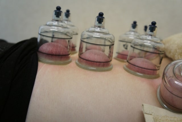 京都市伏見区、さくら鍼灸整骨院、シータヒーリング®、産前産後ケア、産後の骨盤矯正、骨盤矯正、マタニティ整体、アクシスメソッド、アトピー、セルフホワイトニング【併設:さくら整体院、心癒庵(ここゆあん)】