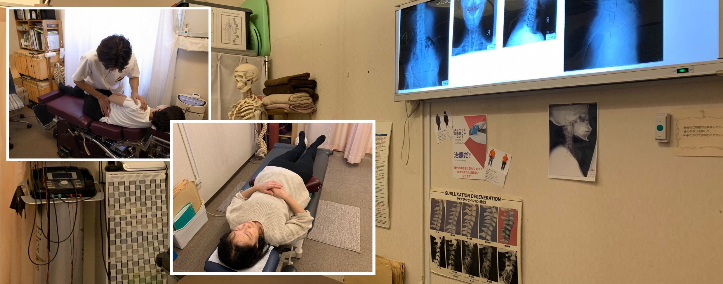 産前産後骨盤矯正