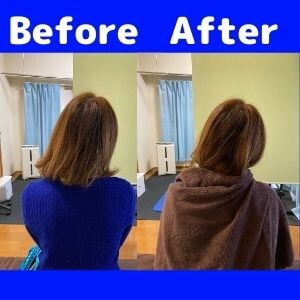 首の可動域改善例