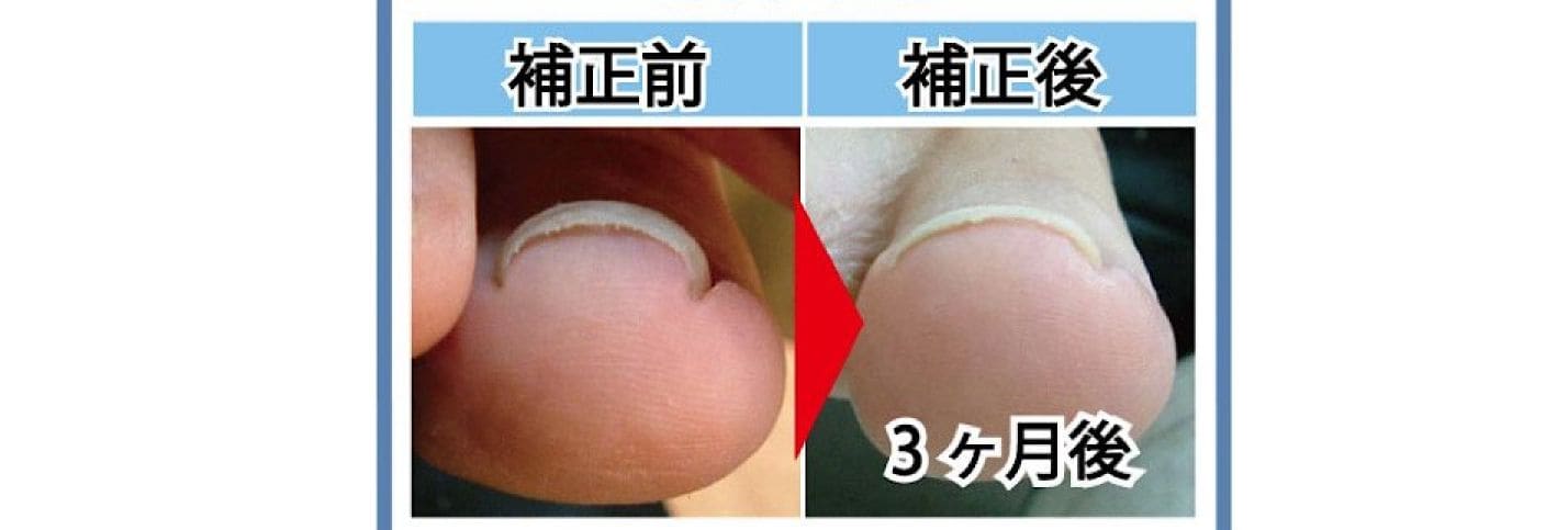 ペディグラステクノロジー　正規取扱店